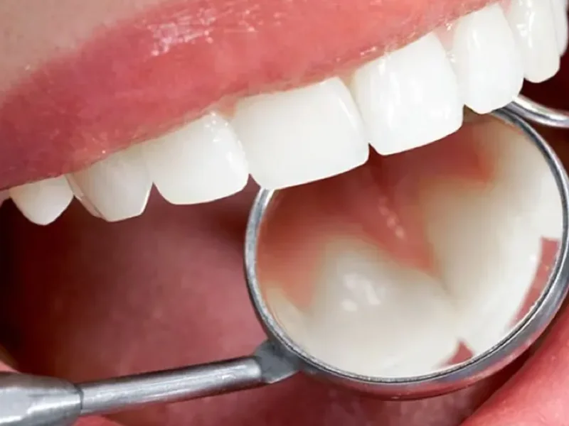Periodontia